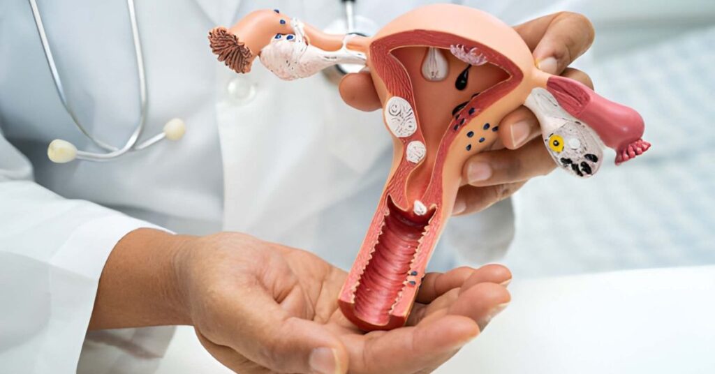 What the Latest News on Cervical Cancer Means for You